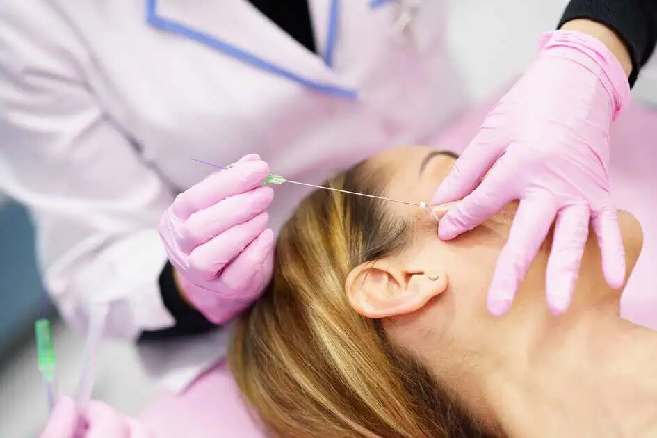 PDO Thread Lift Treatment by Eastside Aesthetics in Redmond, WA