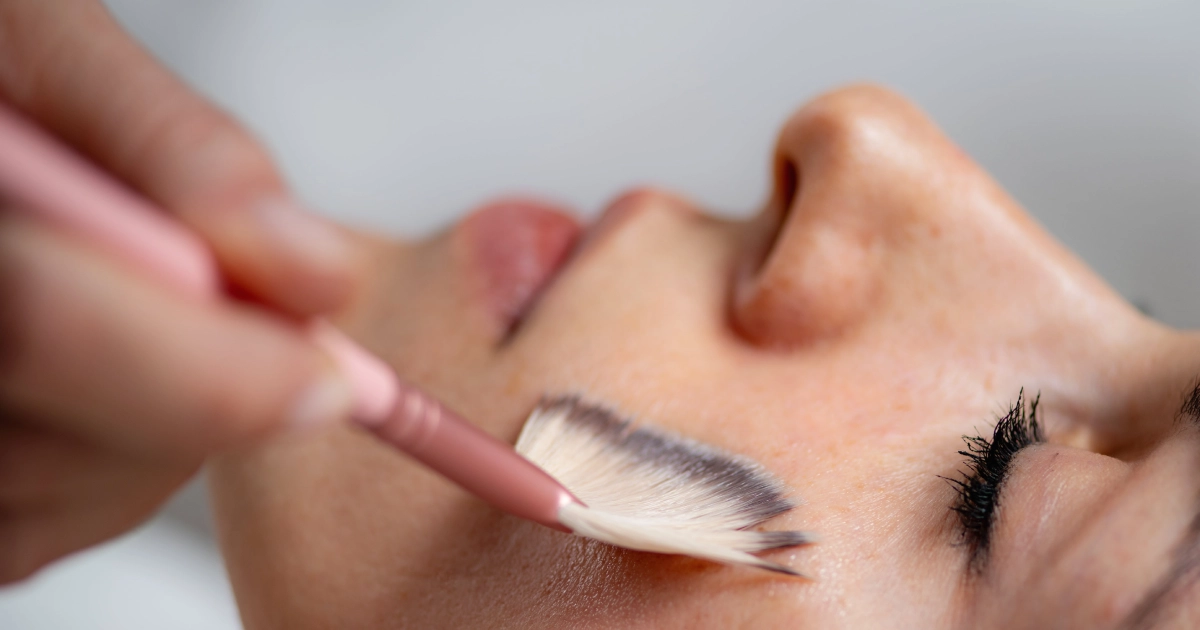 Close-up of a woman receiving a VI Peel treatment in Redmond, WA, with a professional applying the chemical peel solution to her face using a soft brush.