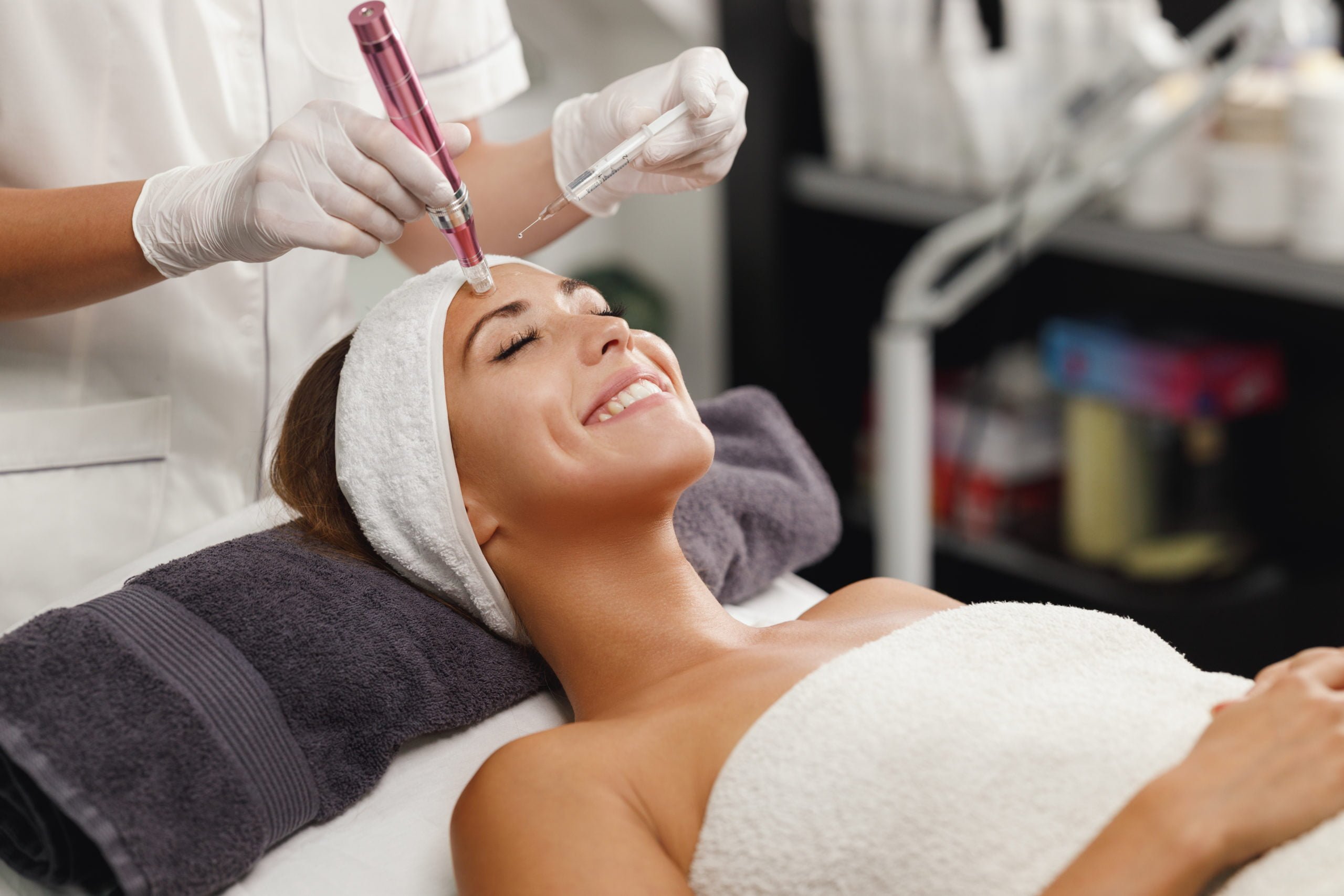 How Microneedling Treatments Saved My Skin Before My Wedding